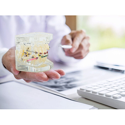 Dental model jaw teeth teeth braces