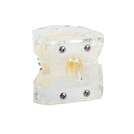 Dental model jaw teeth teeth braces