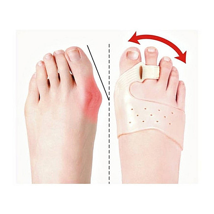 Toe separator for hallux valgus gel wedge magnet