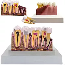 Zoba anatomiskais modelis ar šķērsgriezumu, izņemams, izglītojošs stomatoloģijai