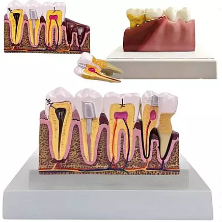 ANATOMICAL TOOTH MODEL (16)