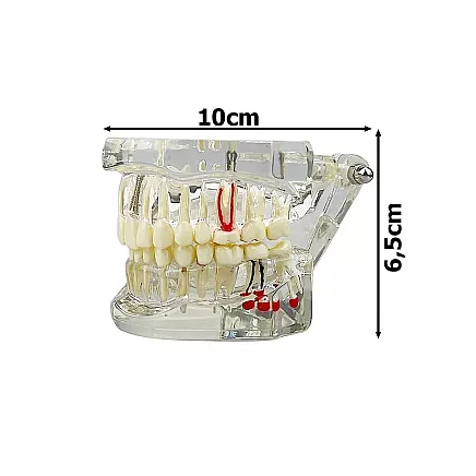 Anatomiskais Stomatoloģiskais Zobu un Žokļa Modelis