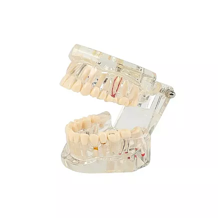 Anatomiskais Stomatoloģiskais Zobu un Žokļa Modelis