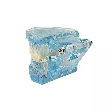 Dental model jaw teeth teeth implants