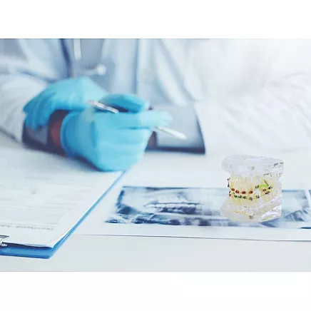 Dental model jaw teeth teeth braces