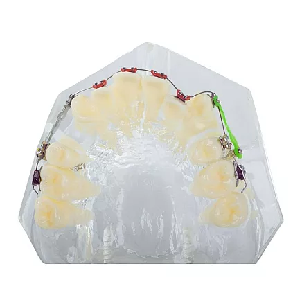 Dental model jaw teeth teeth braces