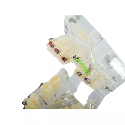 Dental model jaw teeth teeth braces