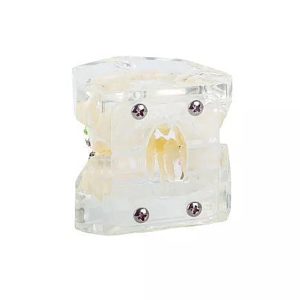 Dental model jaw teeth teeth braces