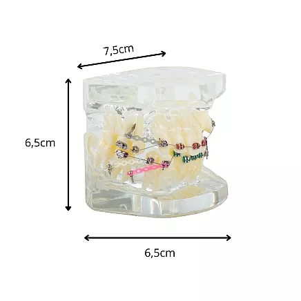 Dental model jaw teeth teeth braces