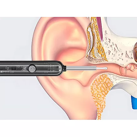 Endoscope otoscope with wifi camera for ear cleaning tools smart kit