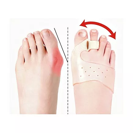 Toe separator for hallux valgus gel wedge magnet